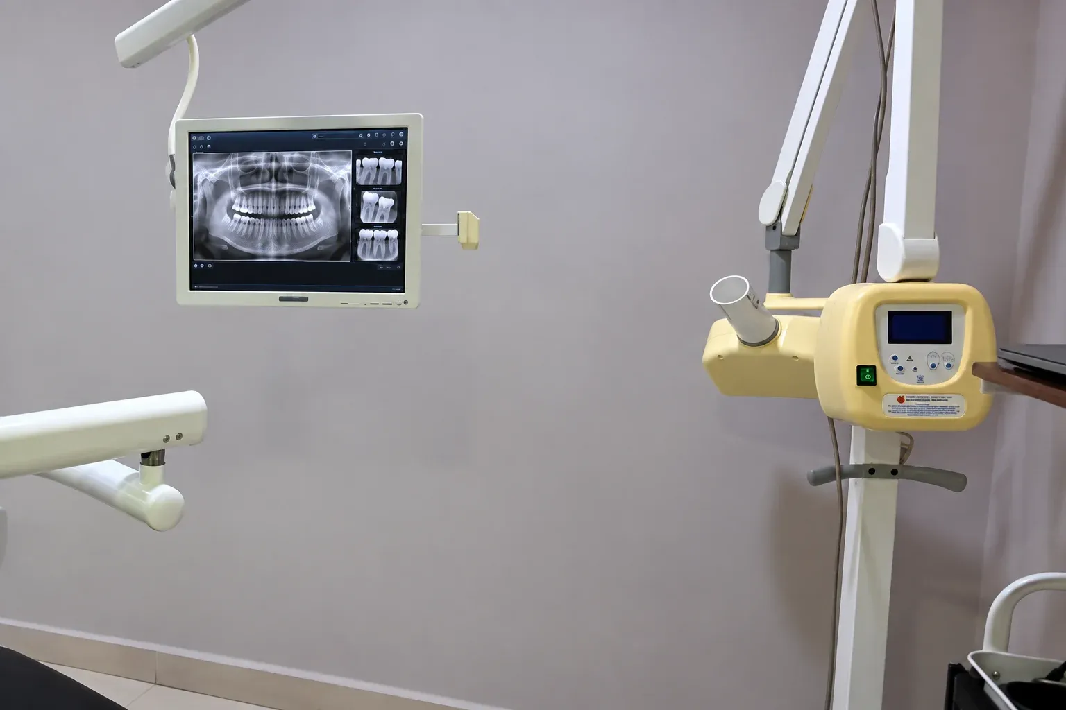 Monitor con una radiografía dental panorámica junto al equipo de rayos X intraoral de un consultorio de Dental Cast